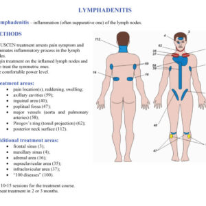 Lymphadentis